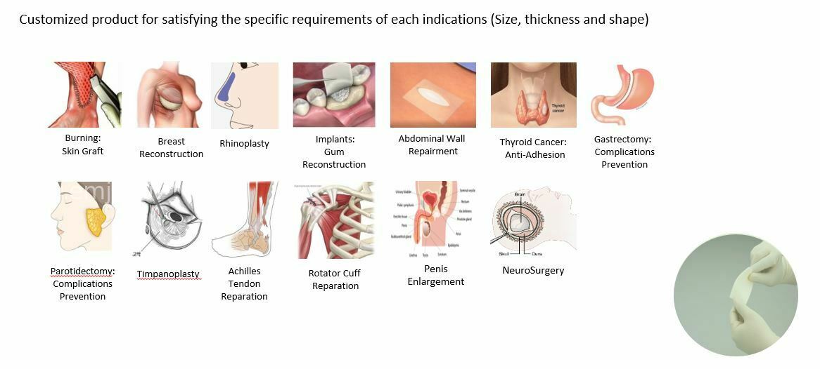 emjj/product/2024/06/10/scpk1rc5b8c7mk97/osteopore